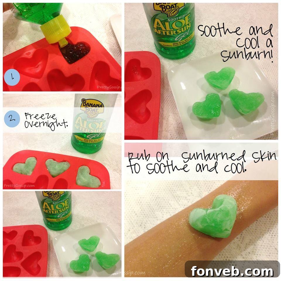 Homemade Cooling Sunburn Treatment
